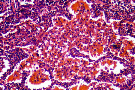 Mikroskop Delta Optical Nexcope NE610