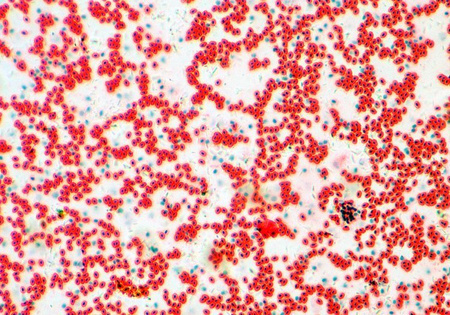 Mikroskop Delta Optical L-1000